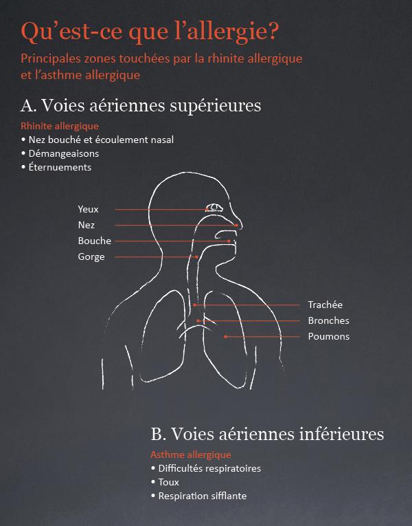 L'asthme allergique | ALK Schweiz - Für ein Leben ohne Allergie