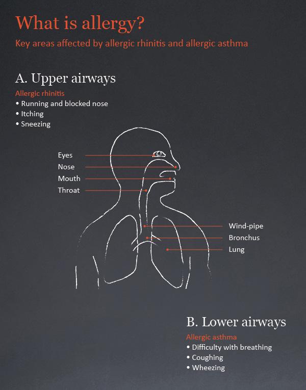 What is Asthma Text Image 1